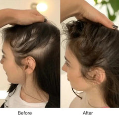 THERALUXE™ RED LIGHT SCALP MASSAGER